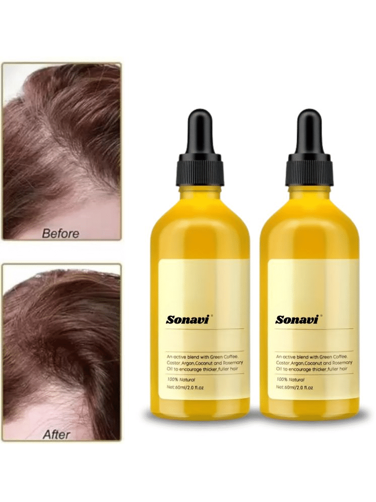     			Sonavi Anti Hair Fall Castor Oil 120 ml ( Pack of 2 )