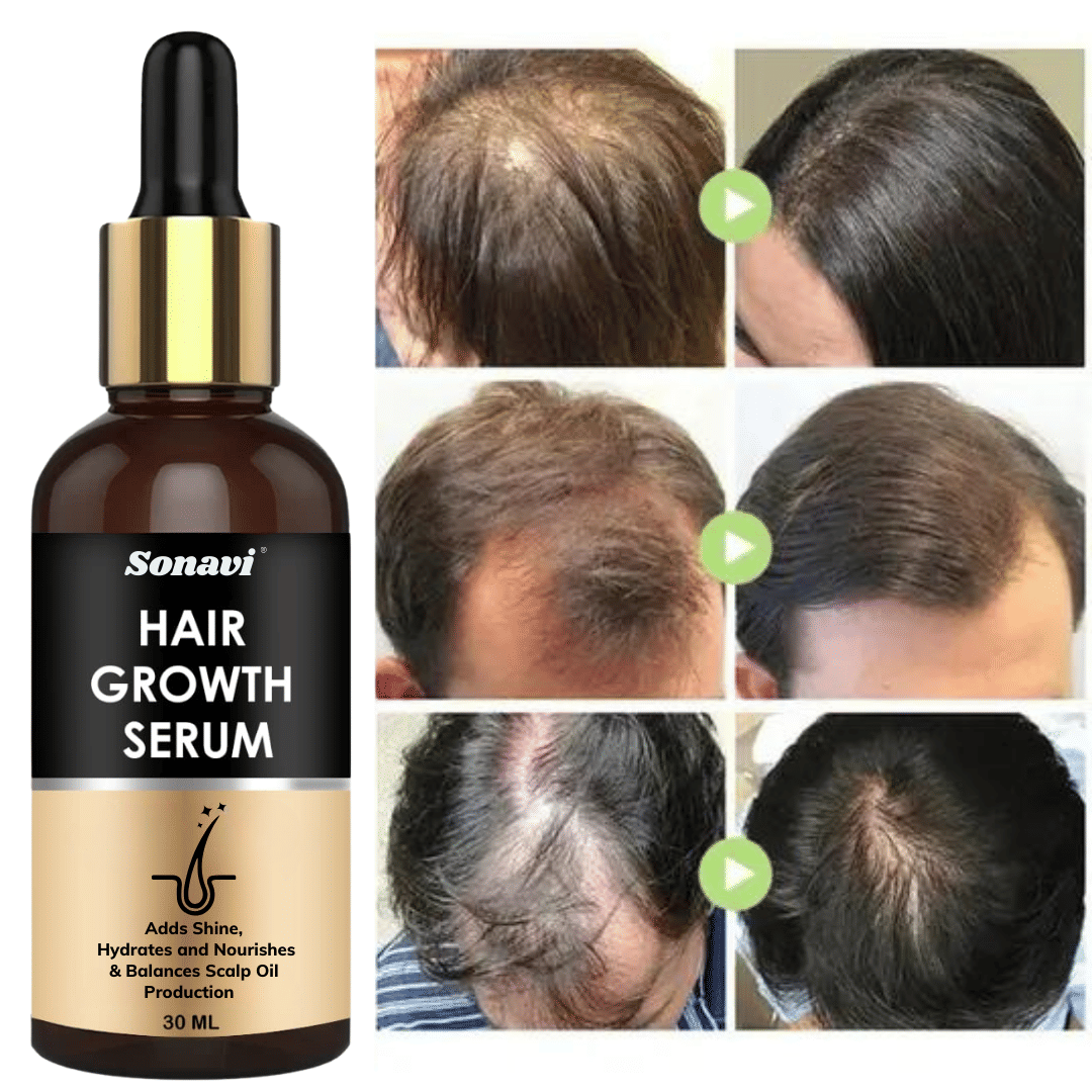 Sonavi Hair Serum 30 mL