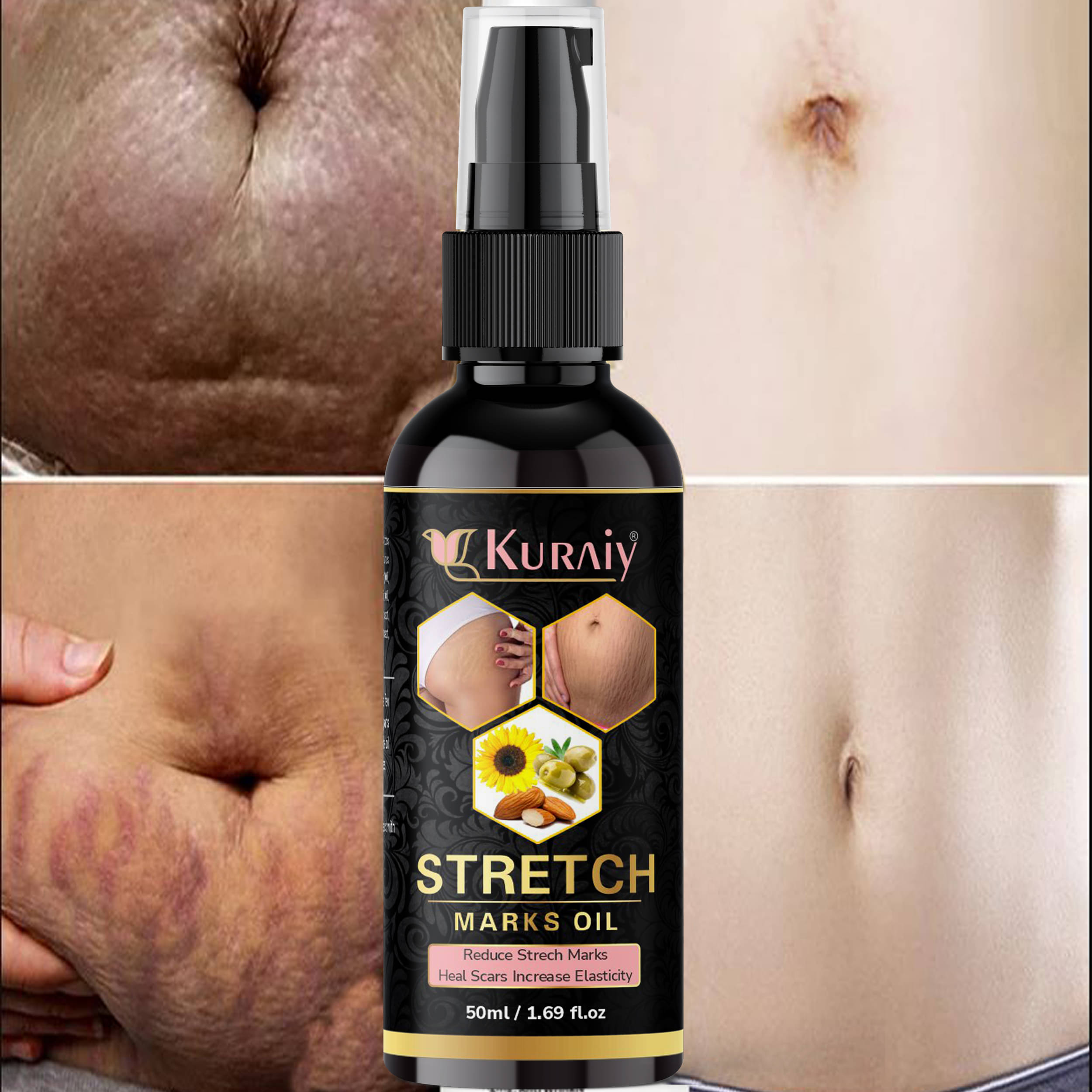     			Kuraiy stretch Oil for Stretch Marks Removal Post Pregnancy stretch mark cream oil (50 ml)