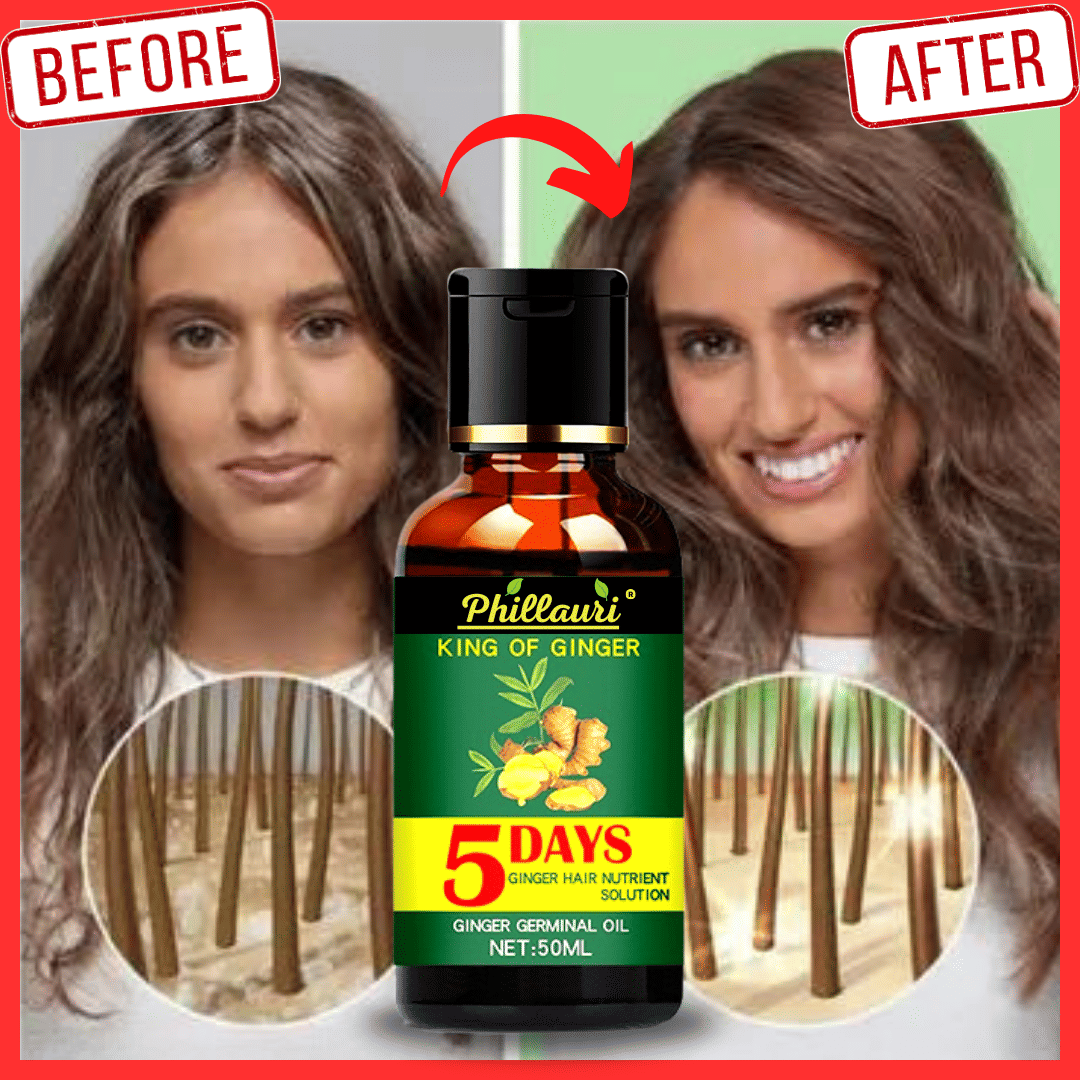     			Phillauri Scalp Treatment Ginger Oil 50 ml ( Pack of 1 )