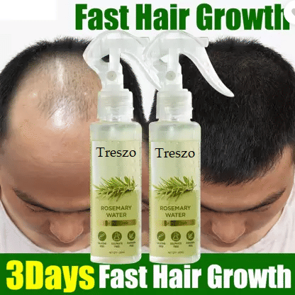     			Treszo Rosemary Hair Spray, 100ml each (Pack of 2)