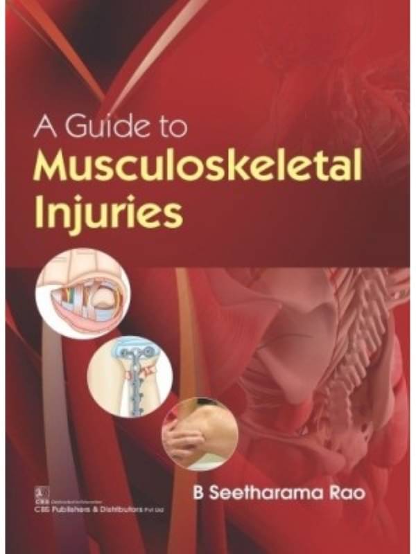 A Guide to Musculoskeletal Injuries A Guide to Musculoskeletal Injuries