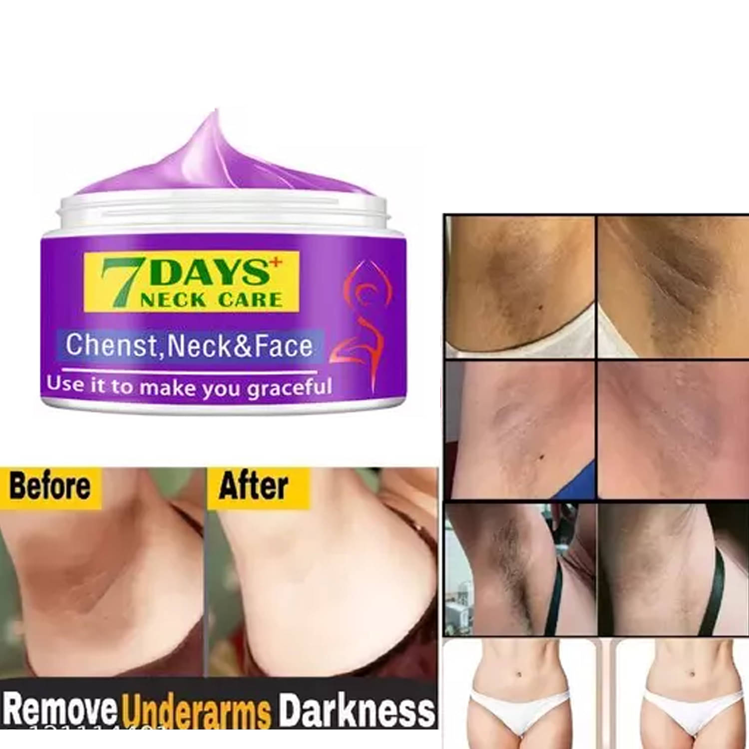     			Treszo Black & White Head Removal Cream ( 50 g )