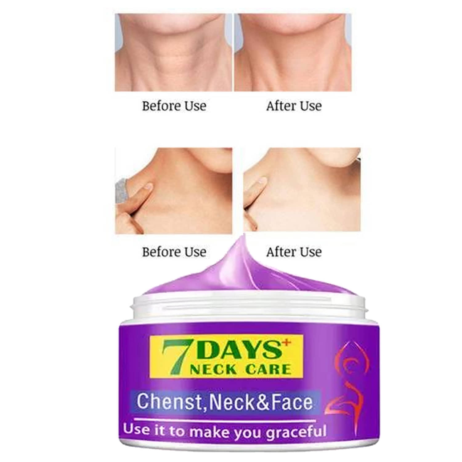 Treszo Black & White Head Removal Cream ( 50 g )
