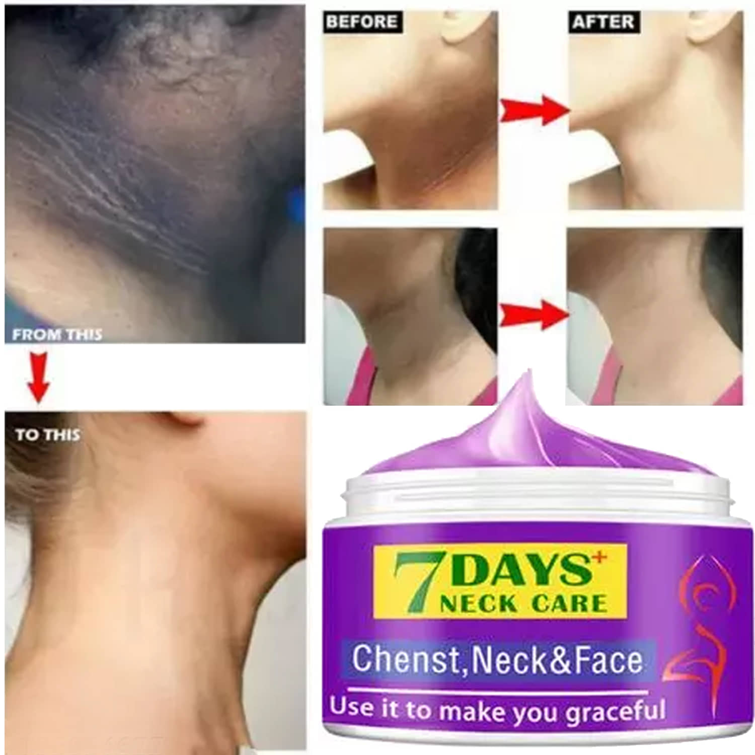 Treszo Black & White Head Removal Cream ( 50 g )