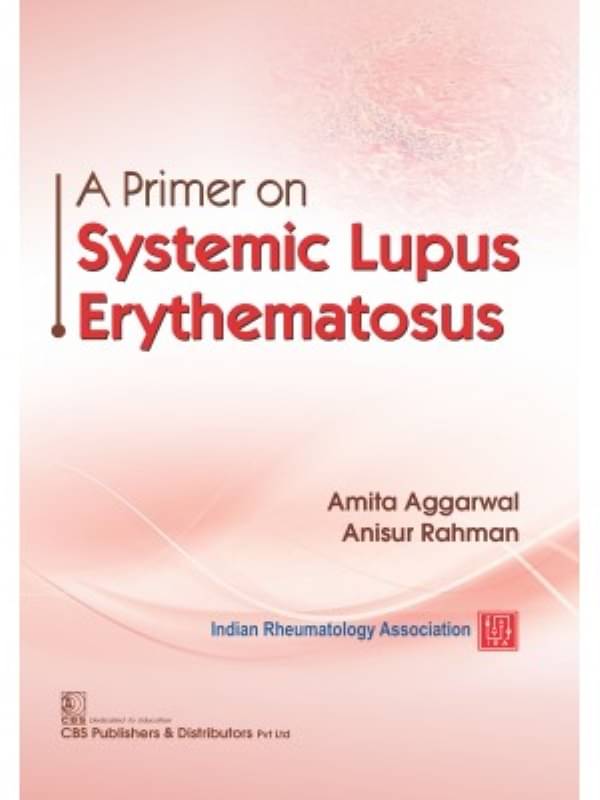 A Primer On Systemic Lupus Erythematosus A Primer On Systemic Lupus Erythematosus