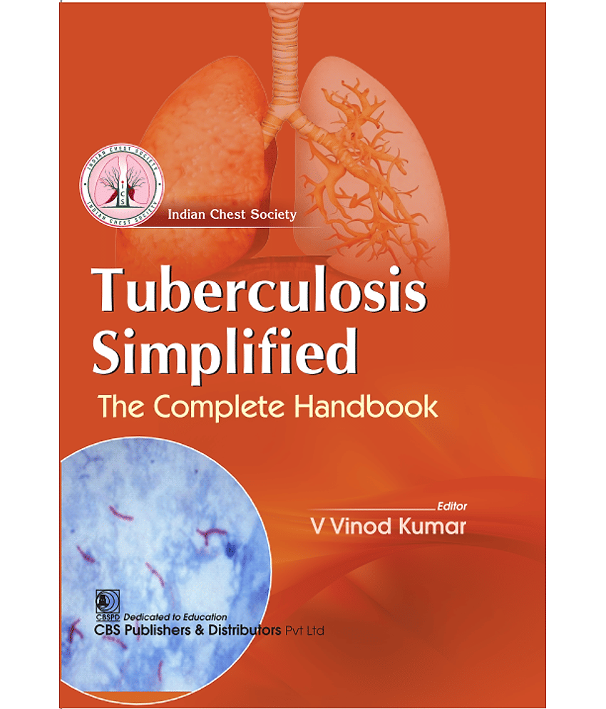 Tuberculosis Simplified: The complete Handbook - Stationery | Buy online on ZillyBuy