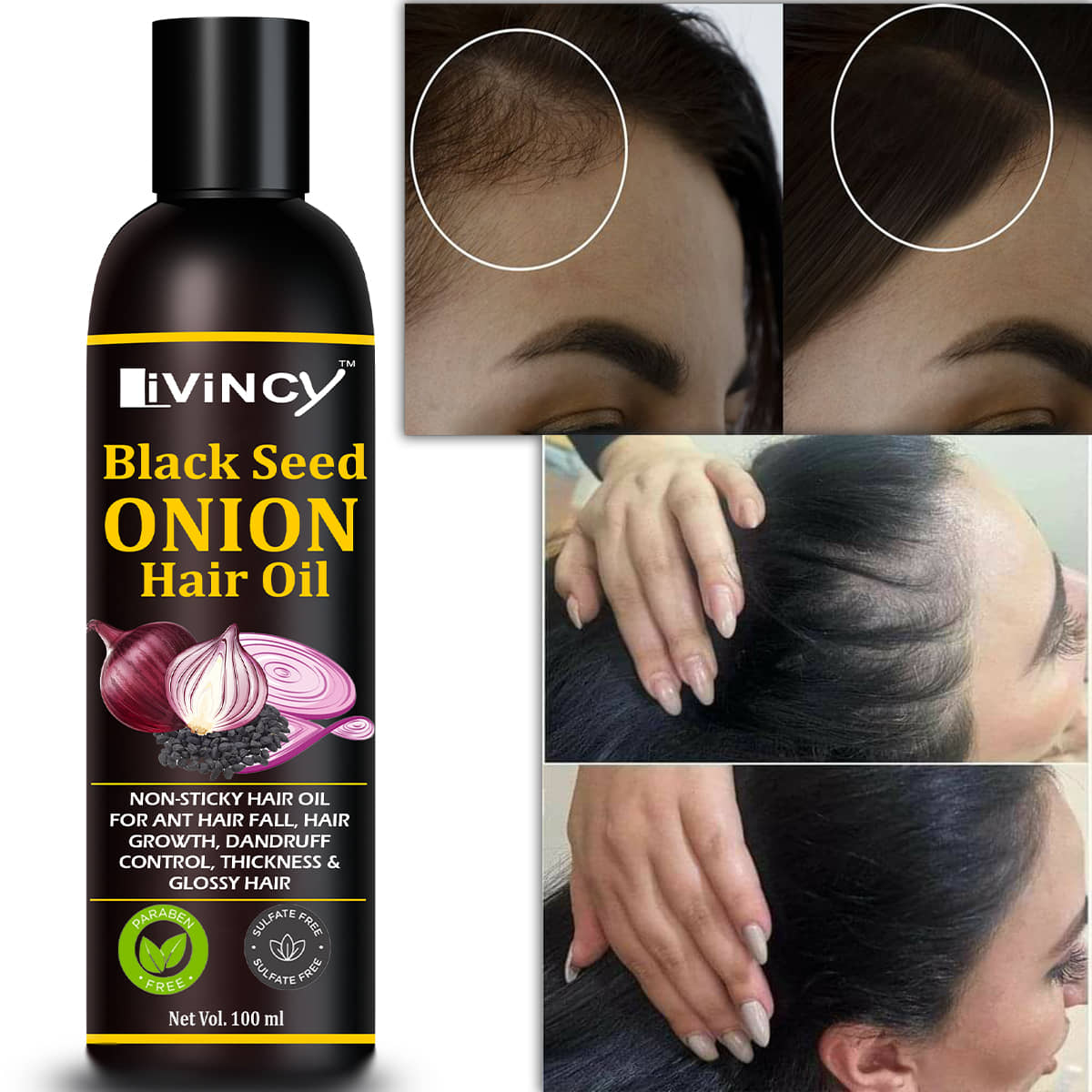 LIVINCY Hair Growth Onion Oil 200 ml ( Pack of 1 )