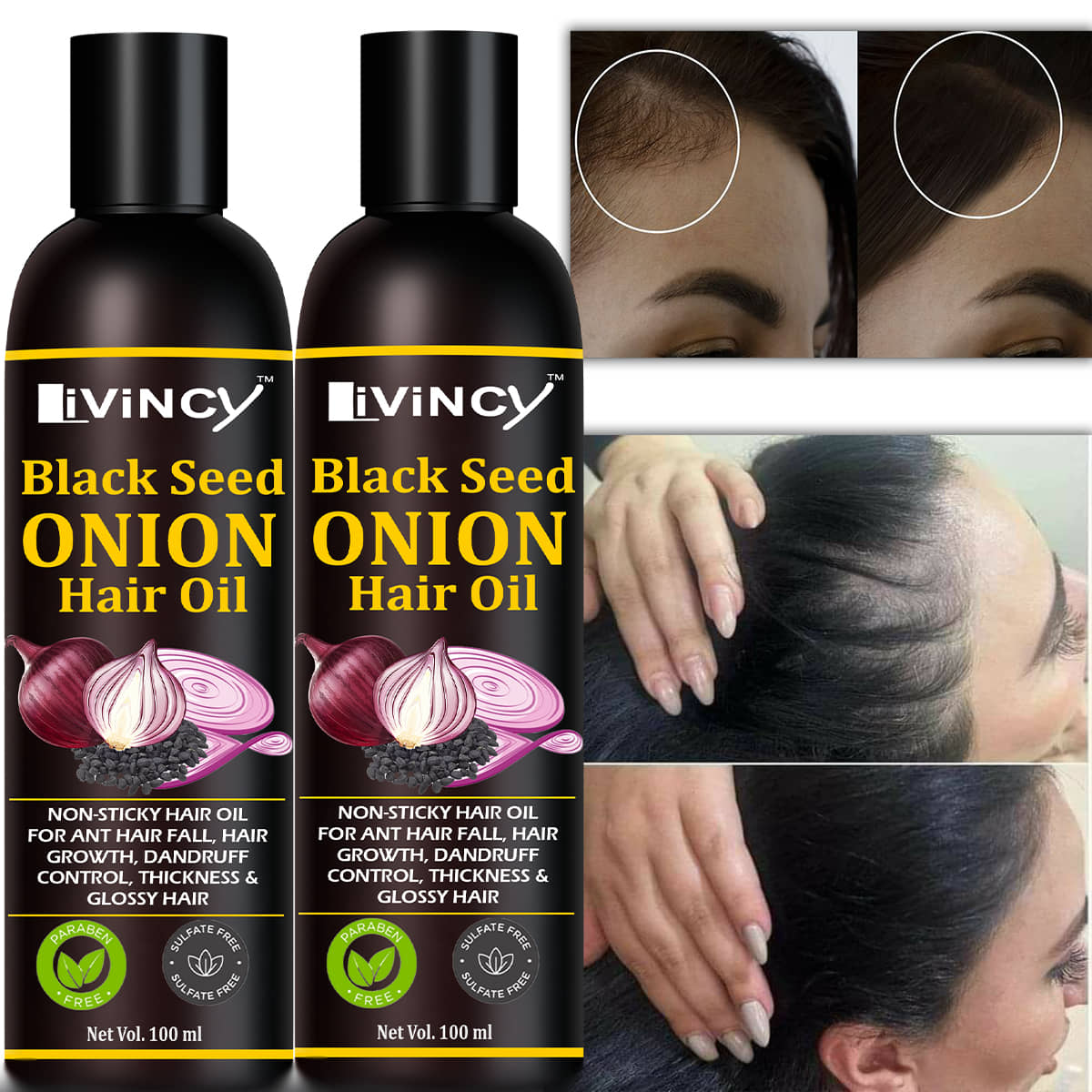 LIVINCY Hair Growth Onion Oil 200 ml ( Pack of 1 )