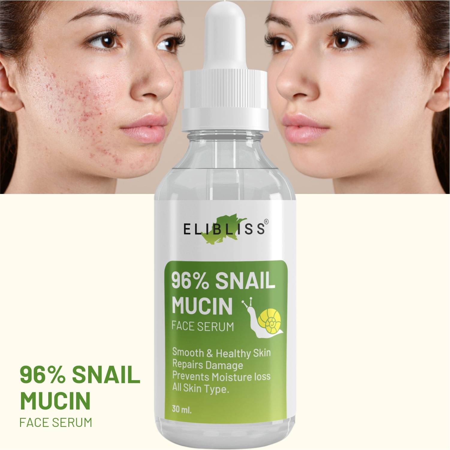 Elibliss Face Serum Snail Mucin Acne Removal For All Skin Type ( Pack of 1 ) Elibliss Face Serum Snail Mucin Acne Removal For All Skin Type ( Pack of 1 )