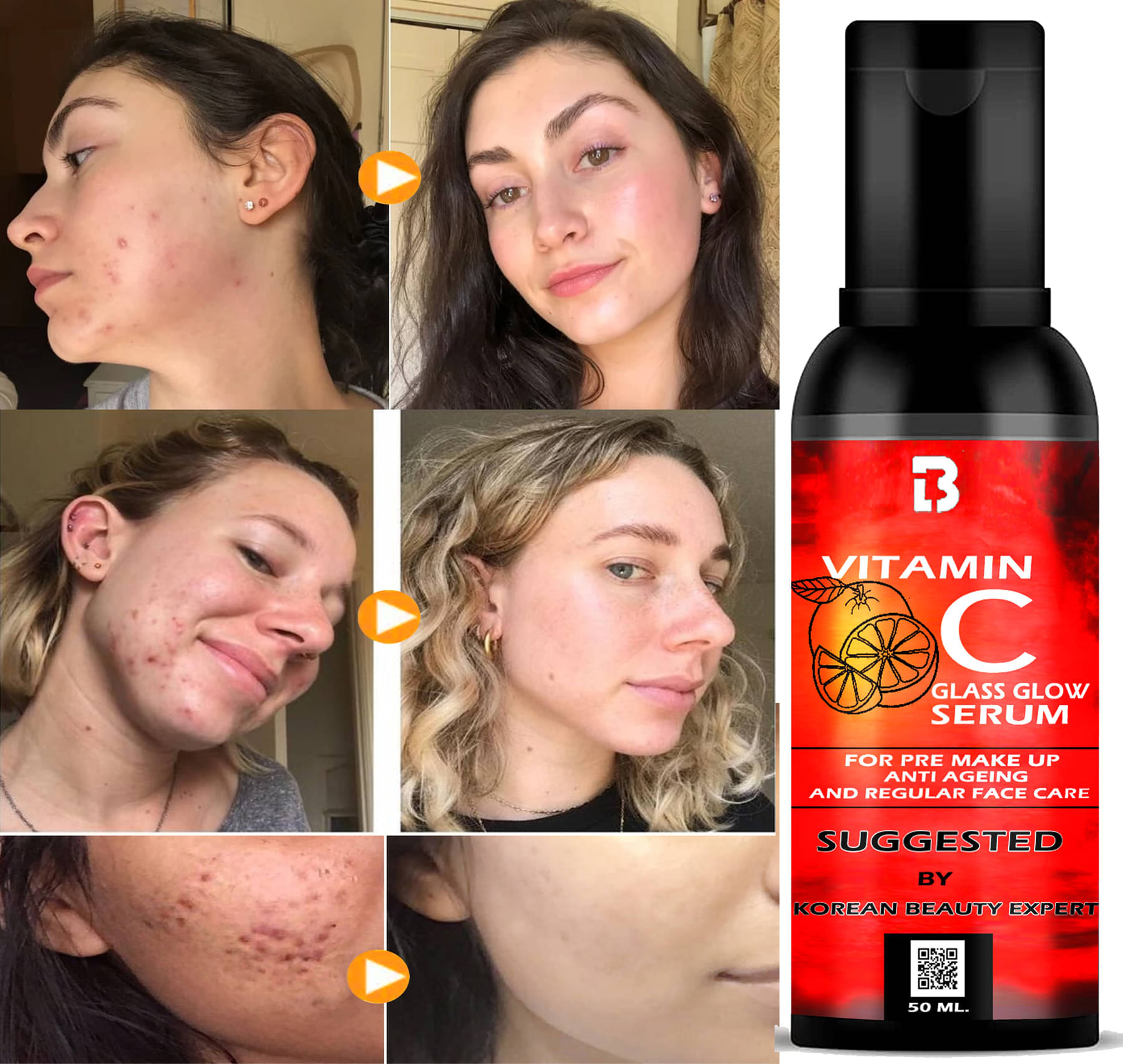     			LA'Beardex Face Serum Vitamin C Spot Removal For Normal Skin ( Pack of 1 )