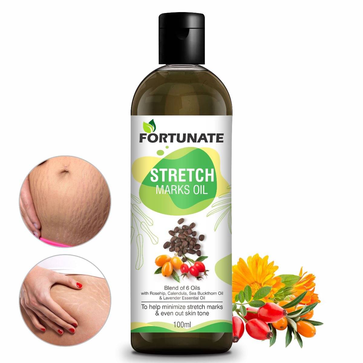     			Stretch Marks Oil to Minimize Stretch Marks & Even Out Skin Tone
