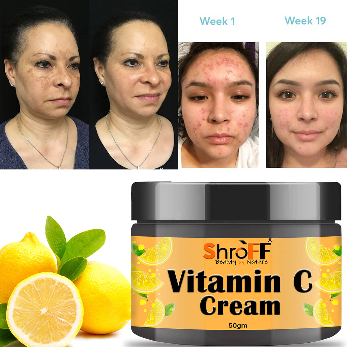     			Shroff Moisturizer Dry Skin Vitamin C ( 50g gm )
