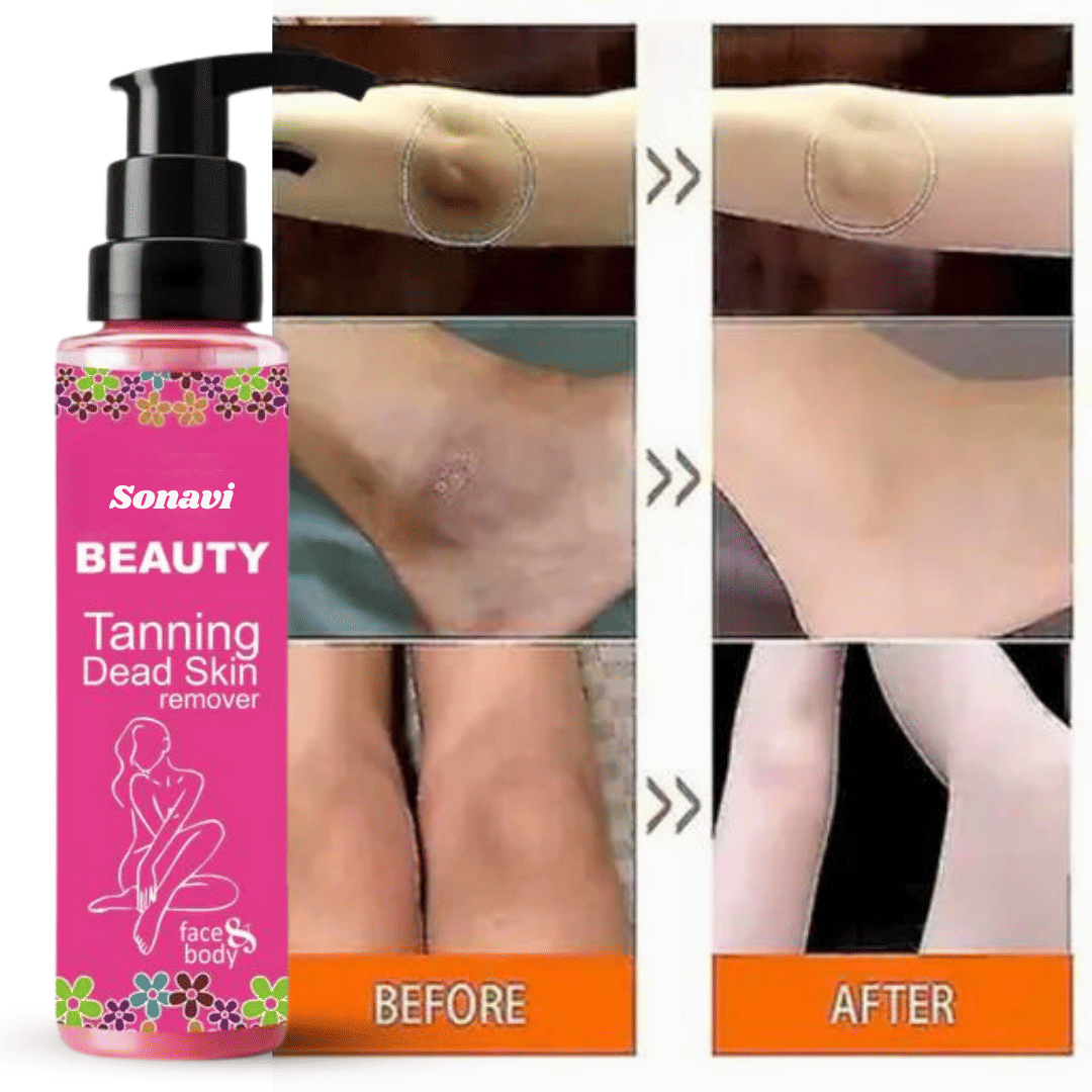 Sonavi Dark Spot Removal Skin Tonic For All Skin Type ( Pack of 1 )