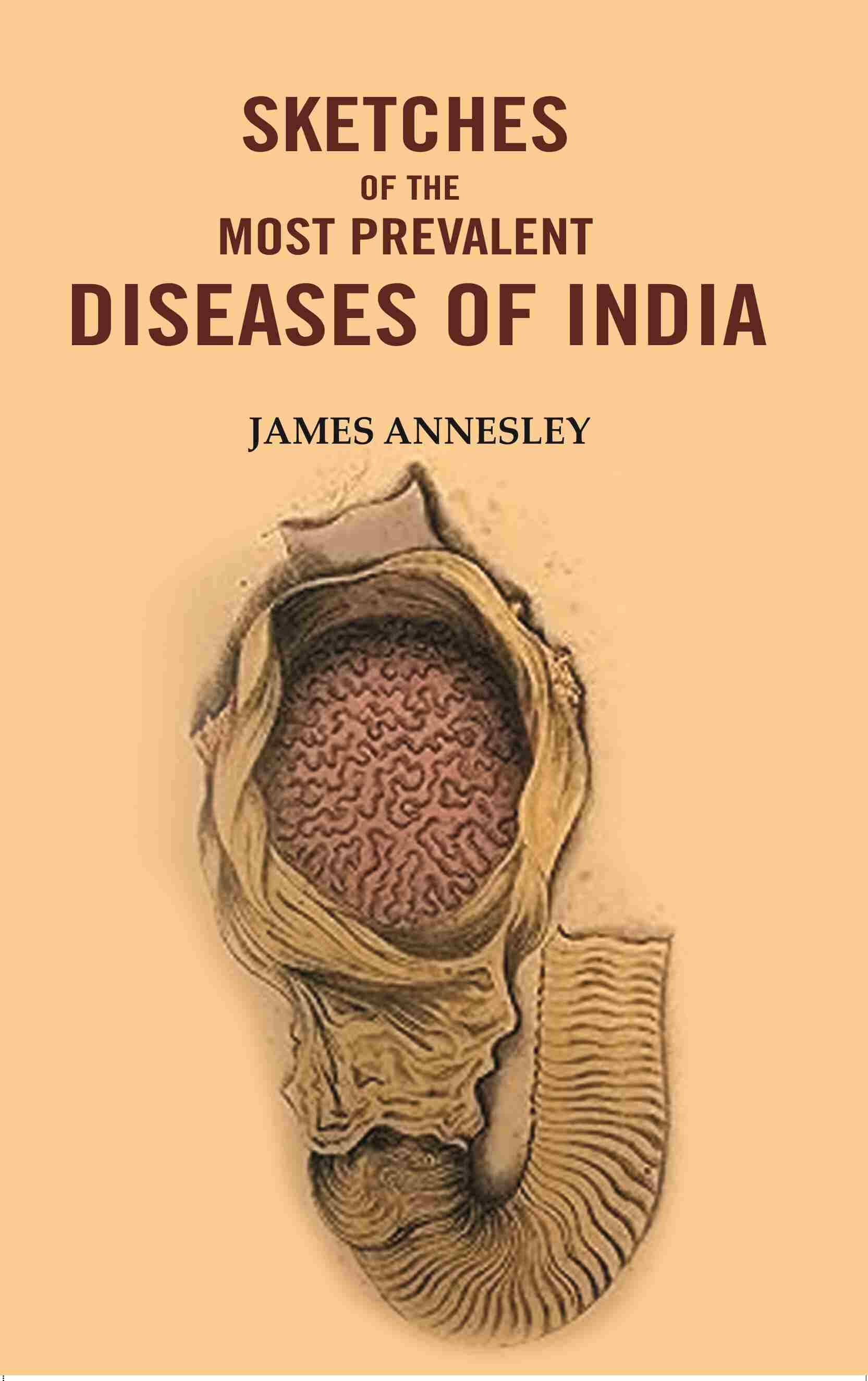     			Sketches of the Most Prevalent Diseases of India