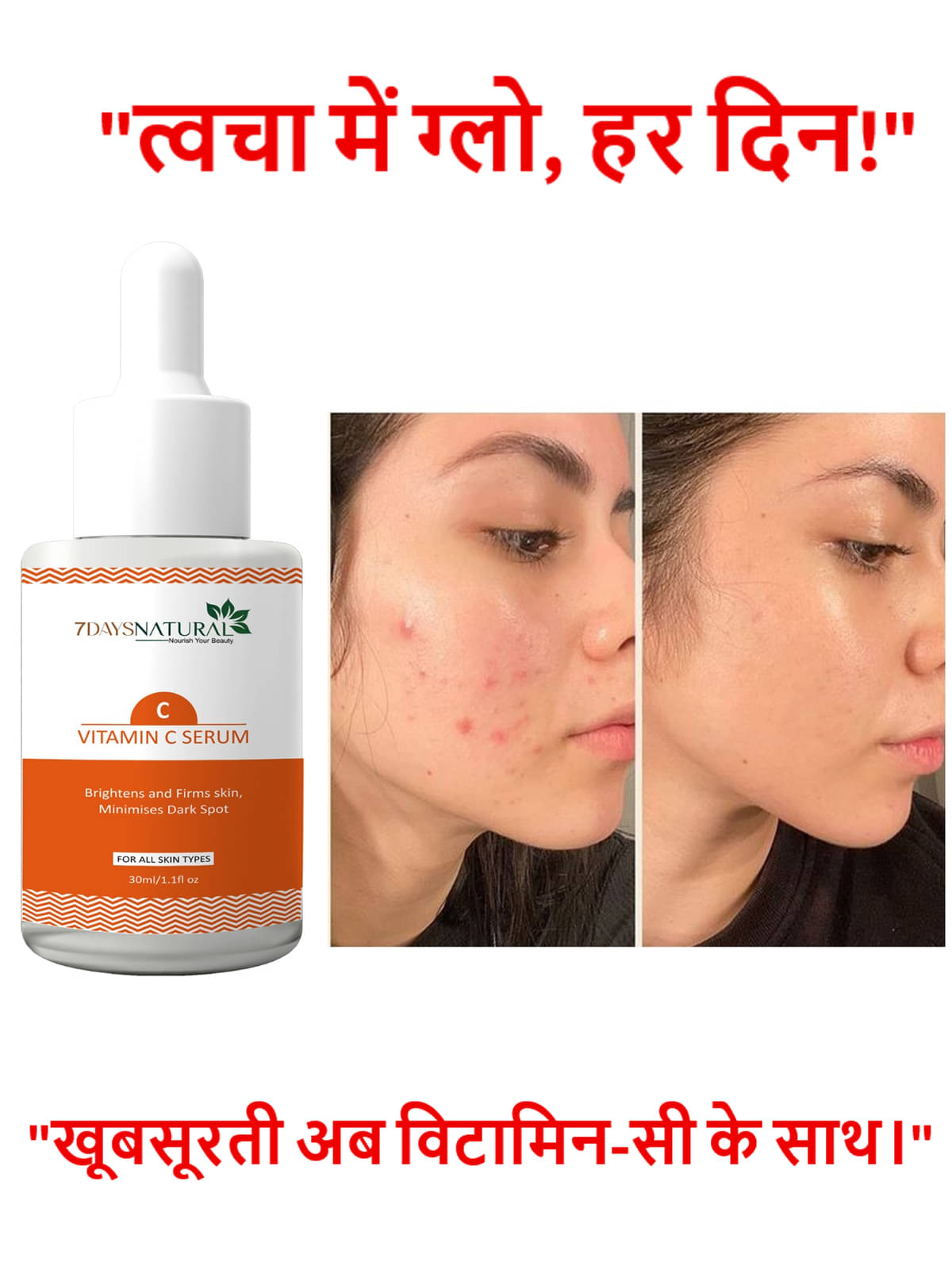 7DAYSNATURAL Face Serum Vitamin C Maintians Skin Complexion For All Skin Type ( Pack of 1 ) 7DAYSNATURAL Face Serum Vitamin C Maintians Skin Complexion For All Skin Type ( Pack of 1 )