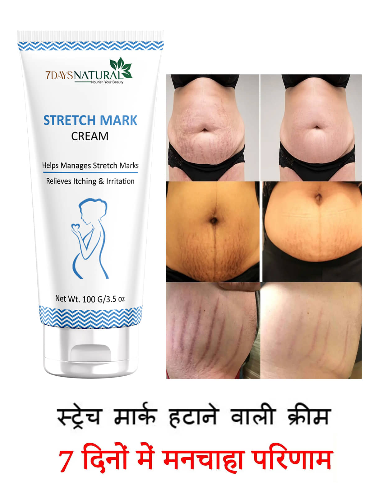 7 days Skin Tightening Cream Floral ( 100 g )