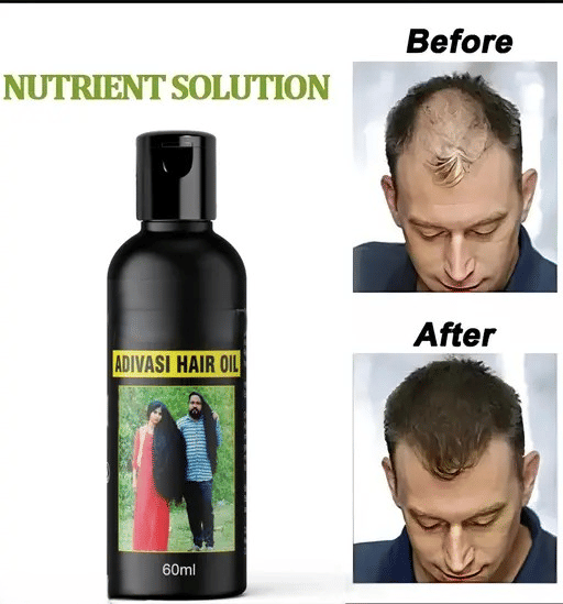     			Generic Damage & Repair Bhringraj Oil 60 ml ( Pack of 1 )