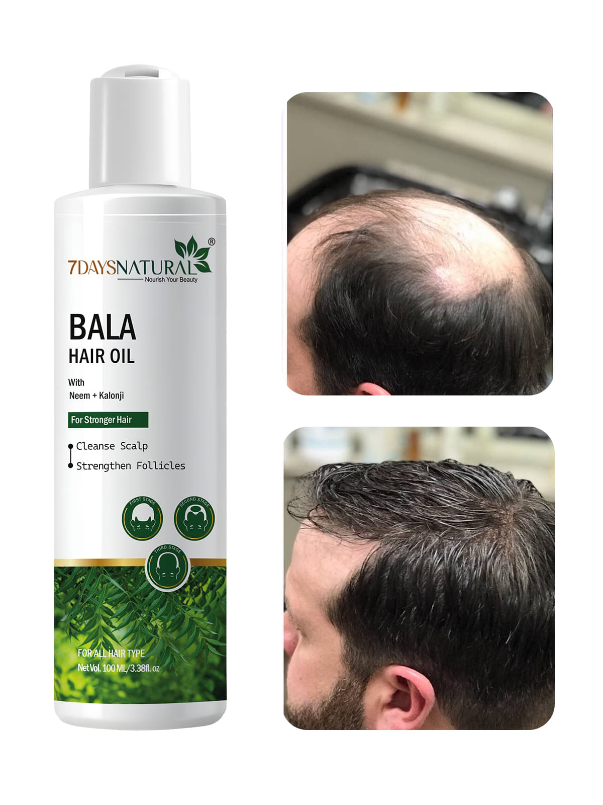     			7 days Damage & Repair Others 100 ml ( Pack of 1 )