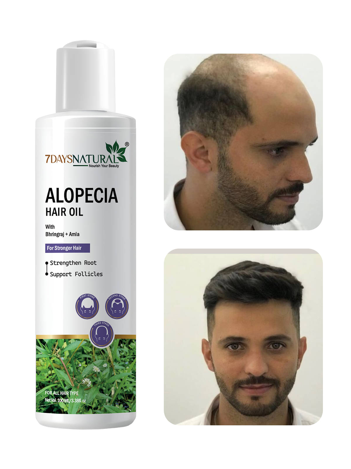     			7 days Scalp Treatment Others 100 ml ( Pack of 1 )