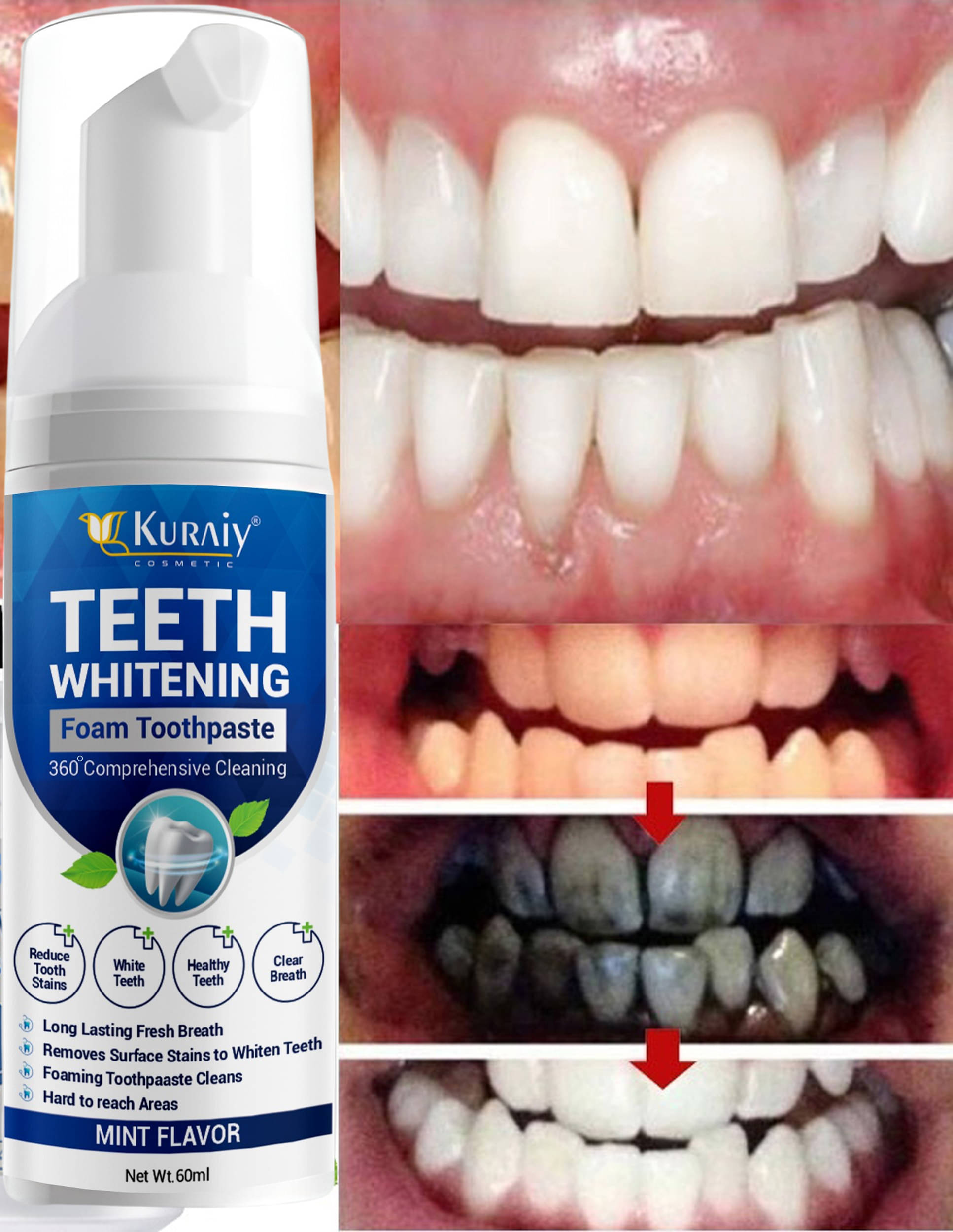     			KURAIY Whitening Toothpaste Pack of 1