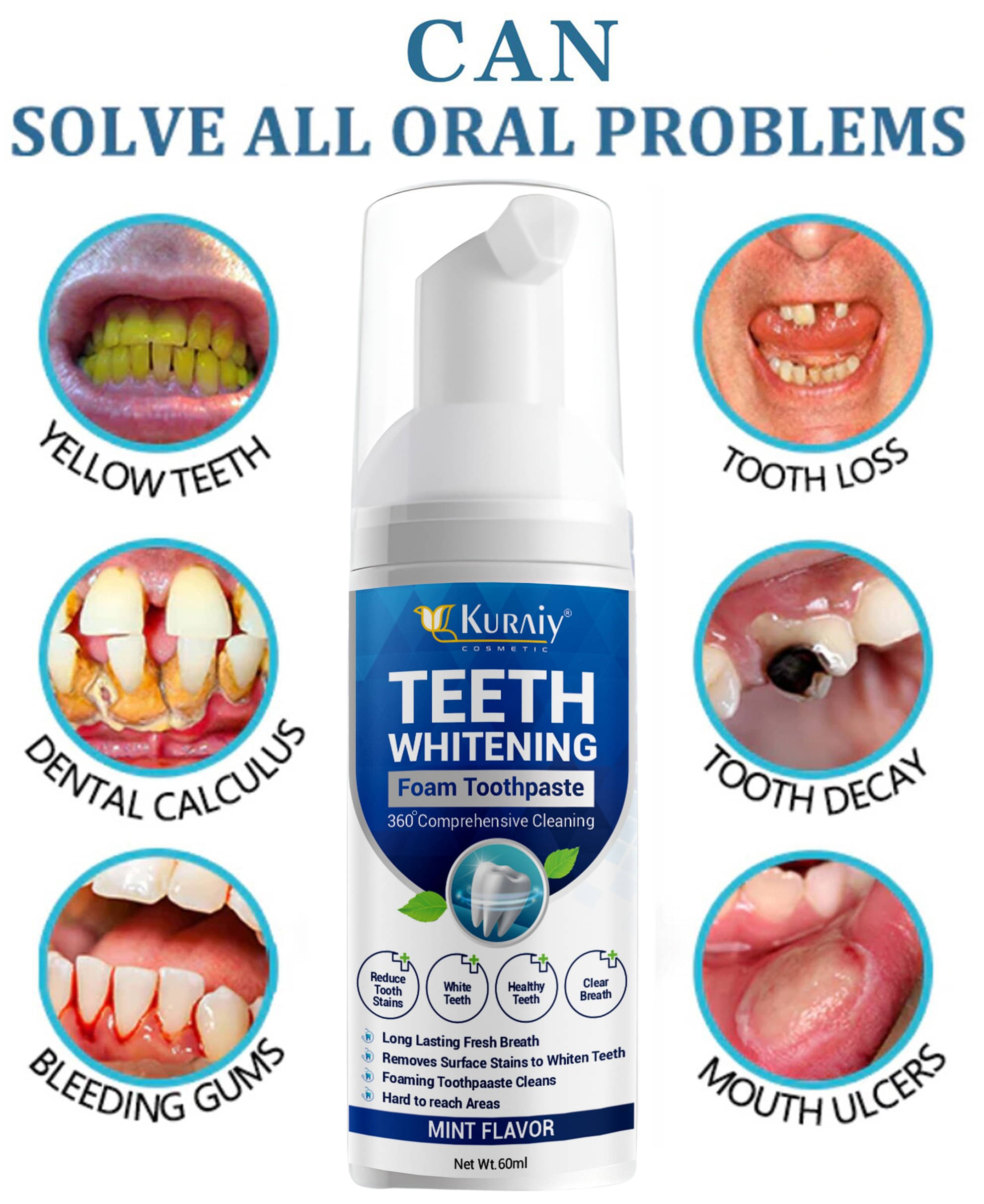     			KURAIY Whitening Toothpaste Pack of 1