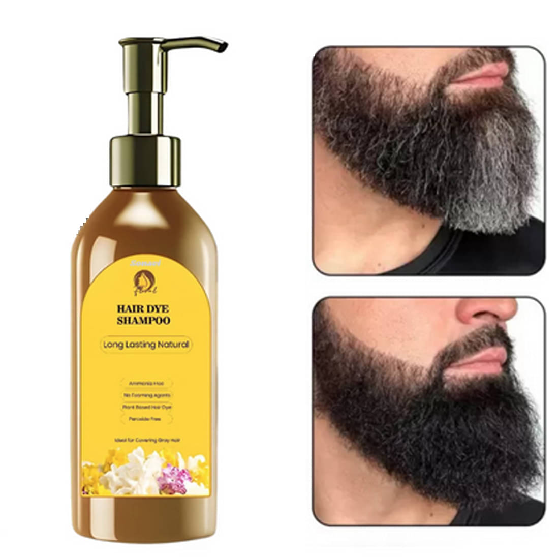     			Vedlekha Anti Dandruff Shampoo 100ML ( Pack of 1 )