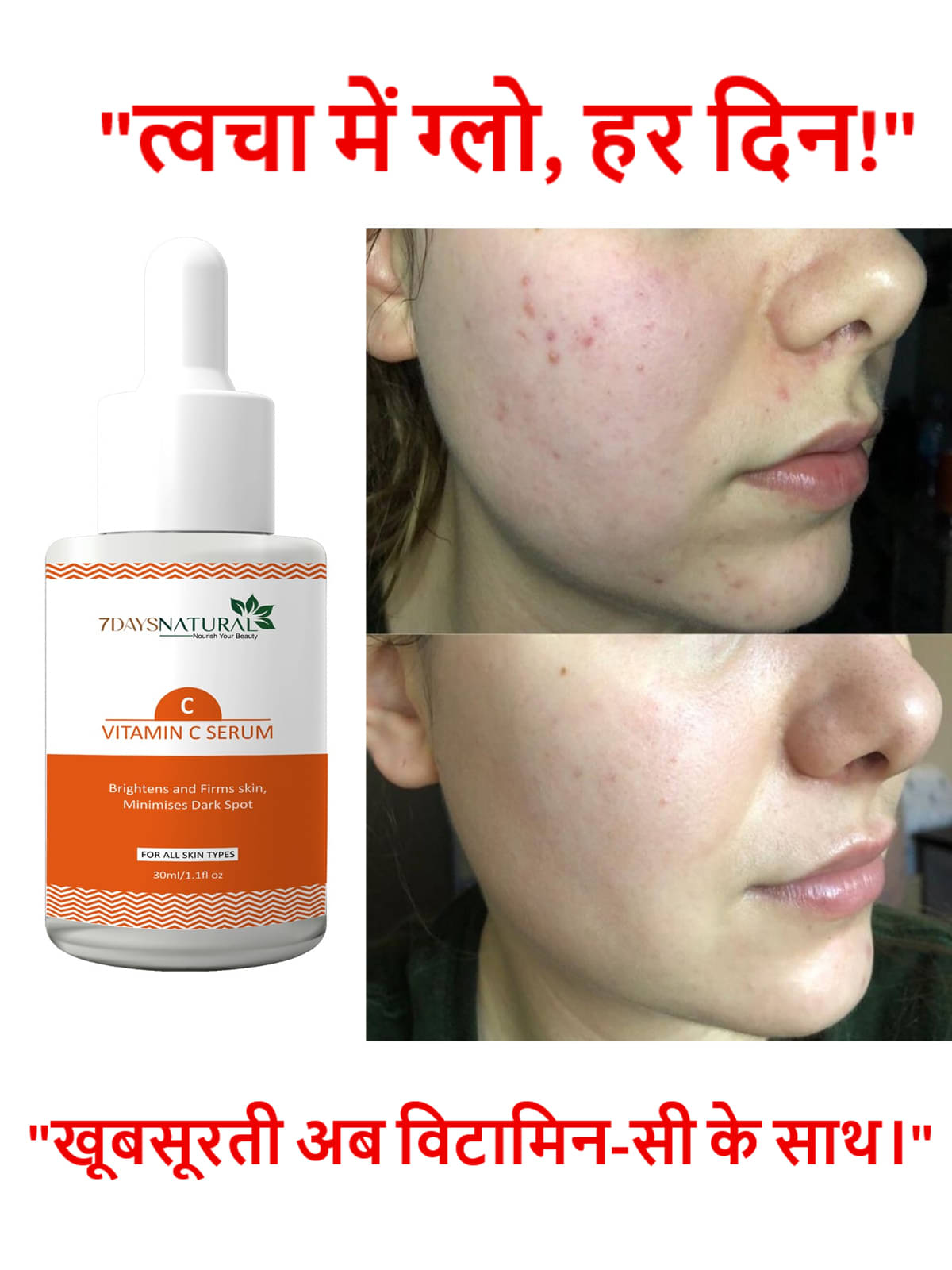 7 days Face Serum Vitamin E Anti-Wrinkle For All Skin Type ( Pack of 1 ) 7 days Face Serum Vitamin E Anti-Wrinkle For All Skin Type ( Pack of 1 )