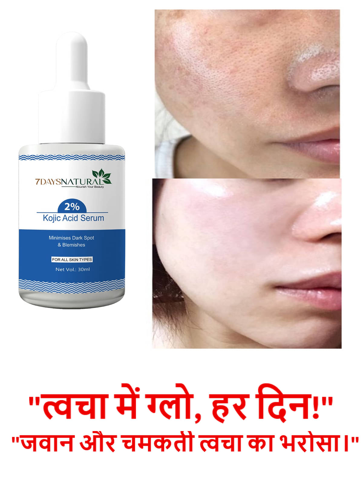     			7DAYSNATURAL Face Serum Kojic Acid Daily Care For All Skin Type ( Pack of 1 )