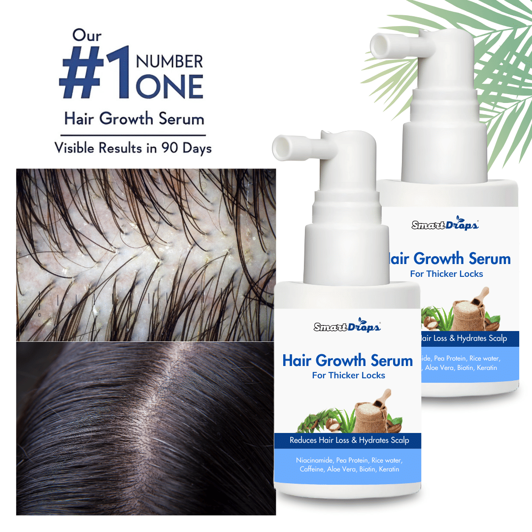 Smartdrops Hair Growth Serum Hair Serum 30 mL Pack of 2