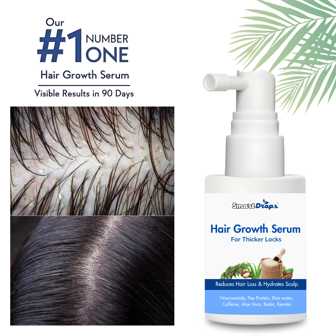 Smartdrops Hair Growth Serum Hair Serum 30 mL