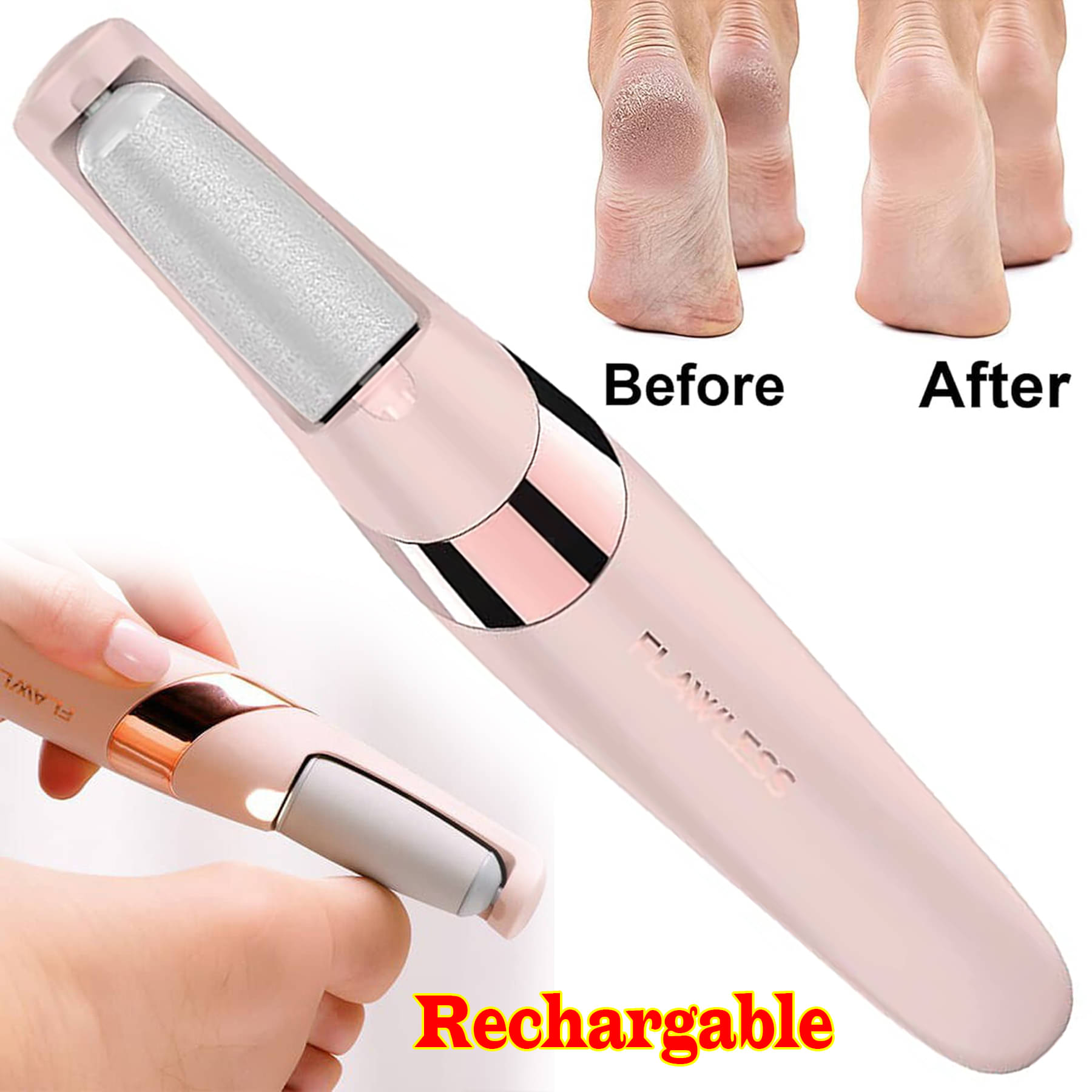 Callus Remover for Feet, ZABOUL Electric Foot Callus Remover Rechargeable Pedicure Tools Smooth Pedicure Wand Electronic Foot File, Feet Care for Removes Dry Hard & Dead Skin Ideal Gift (Pack Of 1) Callus Remover for Feet, ZABOUL Electric Foot Callus Remover Rechargeable Pedicure Tools Smooth Pedicure Wand Electronic Foot File, Feet Care for Removes Dry Hard & Dead Skin Ideal Gift (Pack Of 1)