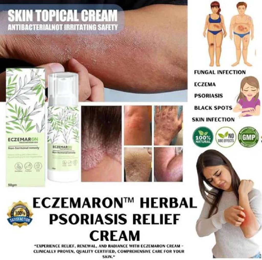 Eczemaron Herbal Anti Fungal Cream For Men & Women 50ml