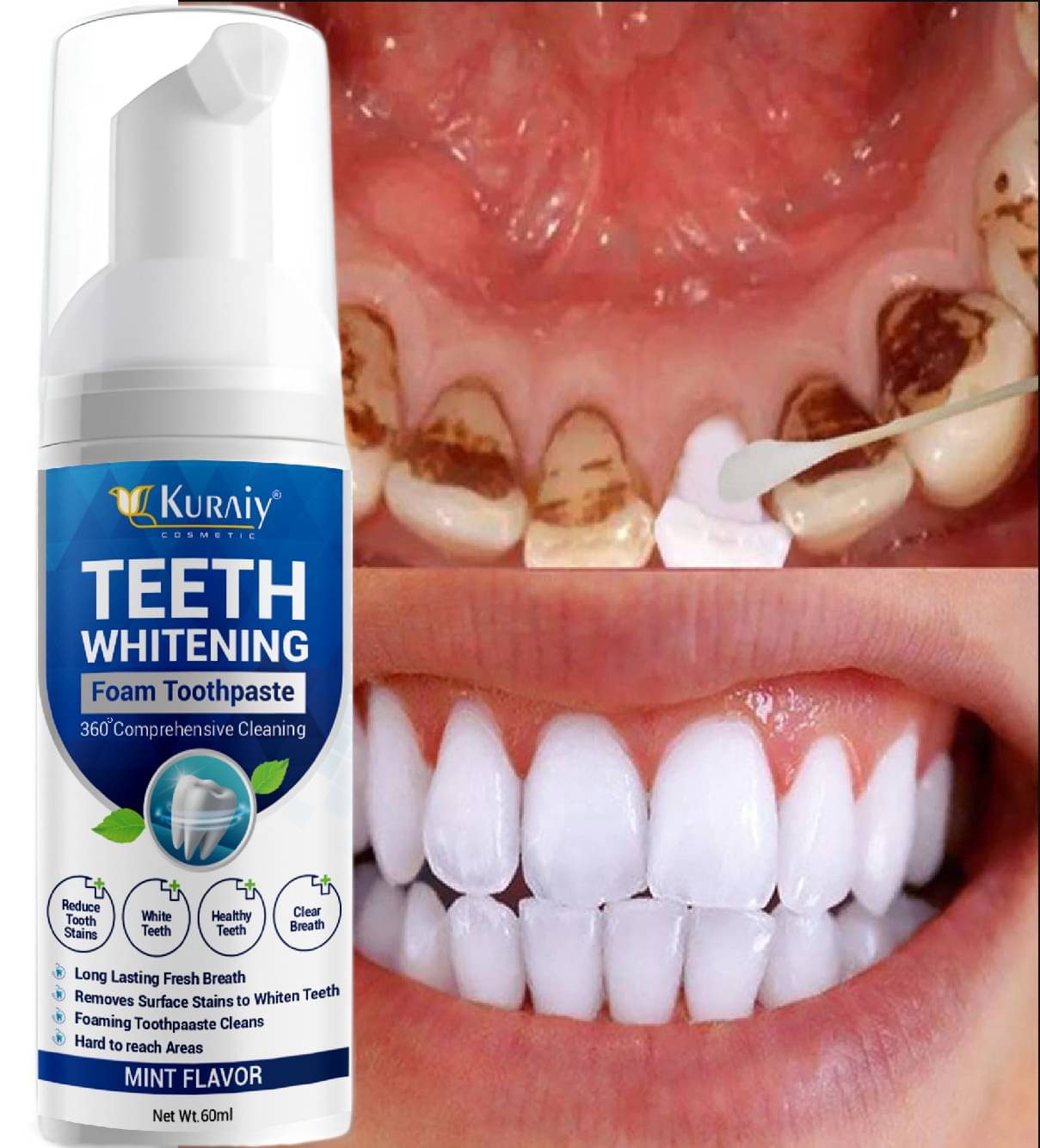     			KURAIY Whitening Toothpaste Pack of 1