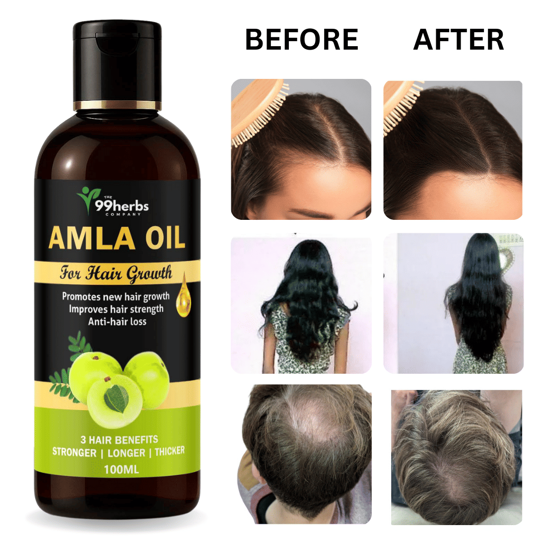 THE 99 HERBS COMPANY Hair Growth Amla Oil 100 ml ( Pack of 1 ) THE 99 HERBS COMPANY Hair Growth Amla Oil 100 ml ( Pack of 1 )
