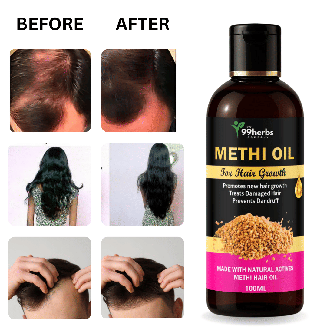THE 99 HERBS COMPANY Hair Growth FenugreekOil 100 ml ( Pack of 1 ) THE 99 HERBS COMPANY Hair Growth FenugreekOil 100 ml ( Pack of 1 )