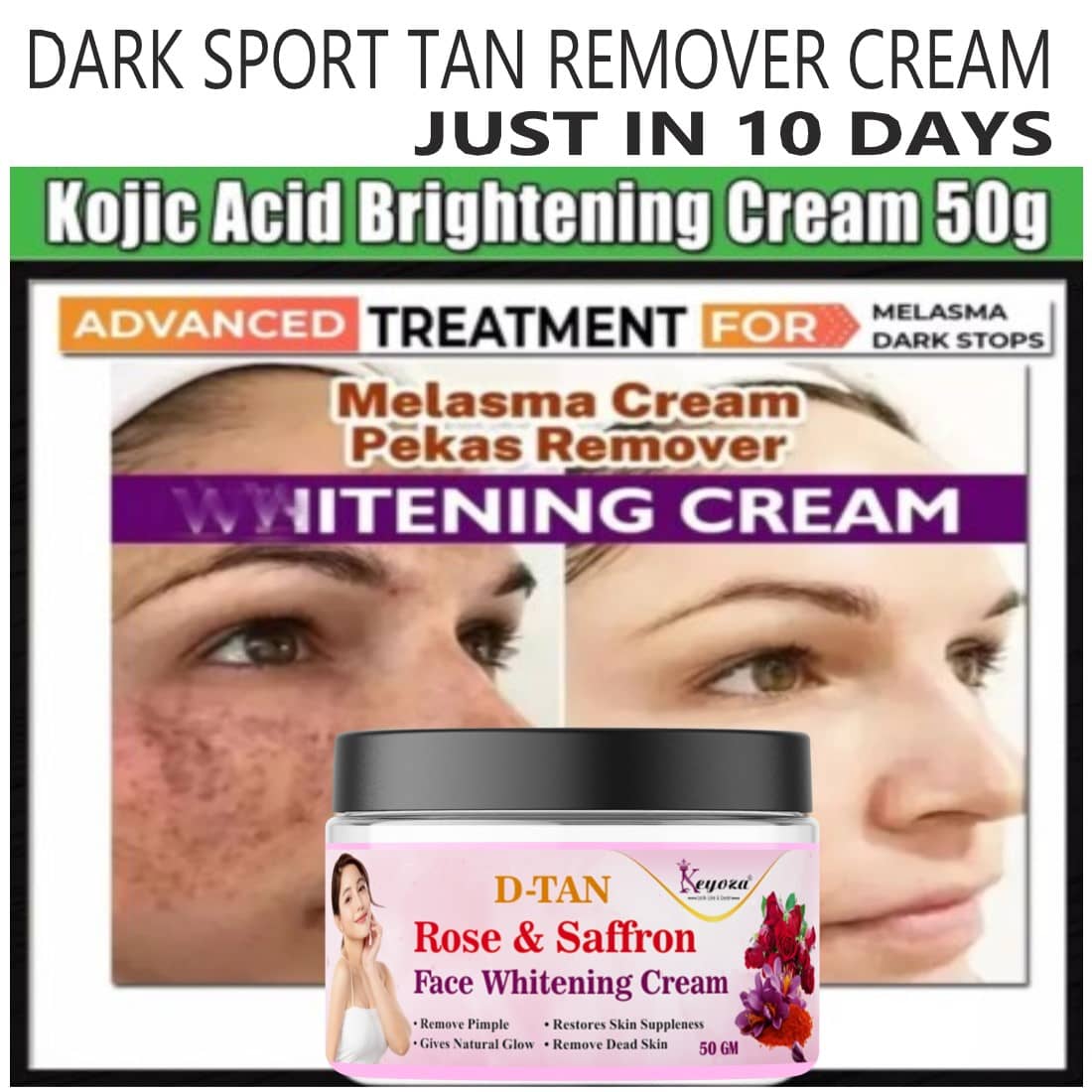 Keyoza Moisturizer All Skin Type Rose ( 50GM  gm )