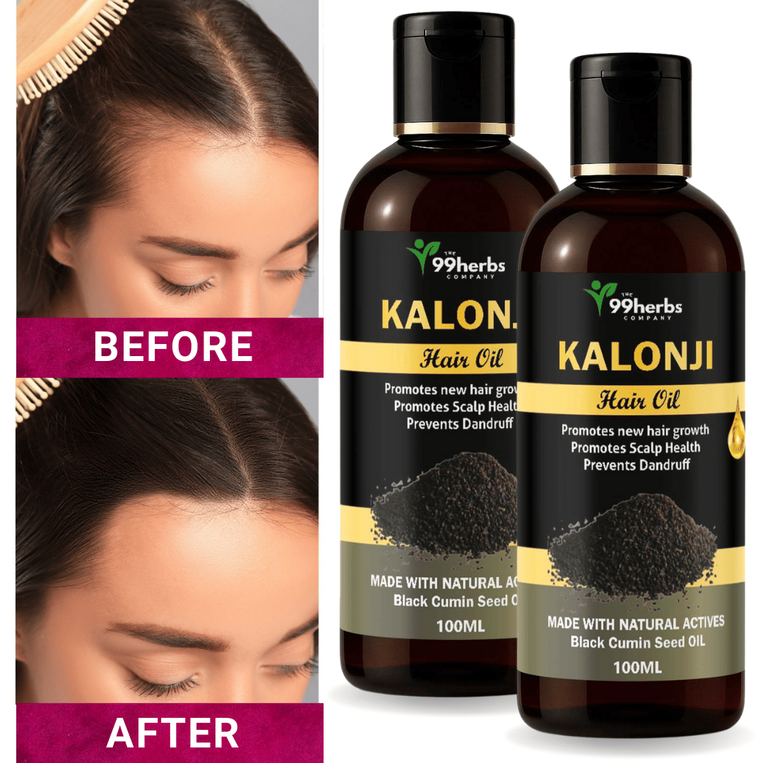 THE 99 HERBS COMPANY Hair Growth Kalonji Oil 100 ml ( Pack of 2 ) THE 99 HERBS COMPANY Hair Growth Kalonji Oil 100 ml ( Pack of 2 )