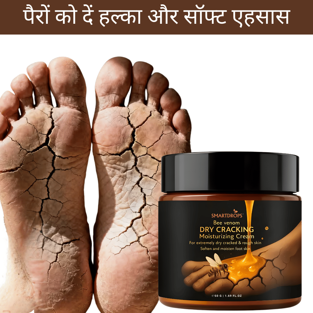 Smartdrops Cracked skin repair Cream for All year ( 50 g ) Smartdrops Cracked skin repair Cream for All year ( 50 g )