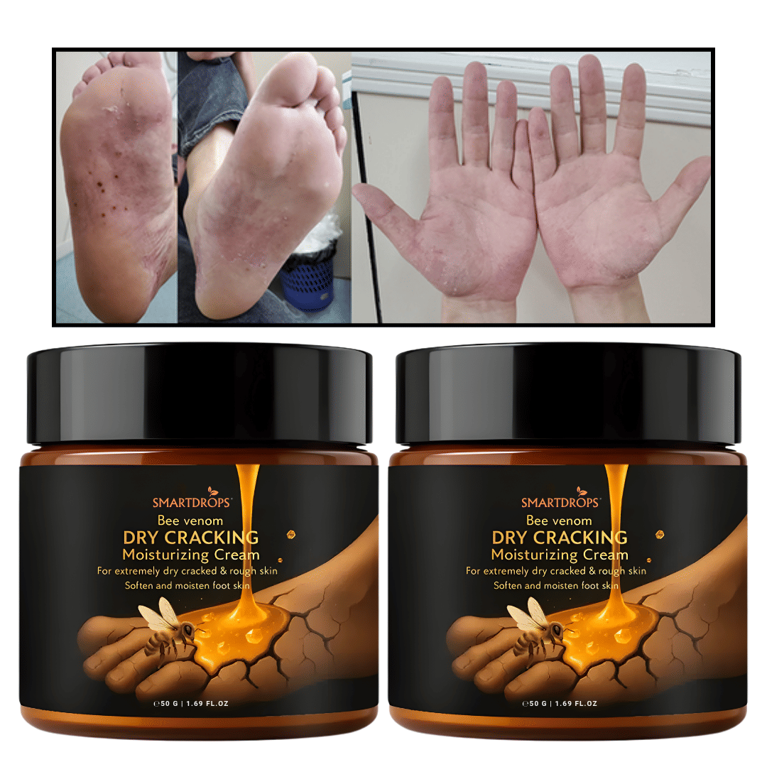 Smartdrops Cracked skin repair Cream for All year ( 100 g ) Smartdrops Cracked skin repair Cream for All year ( 100 g )