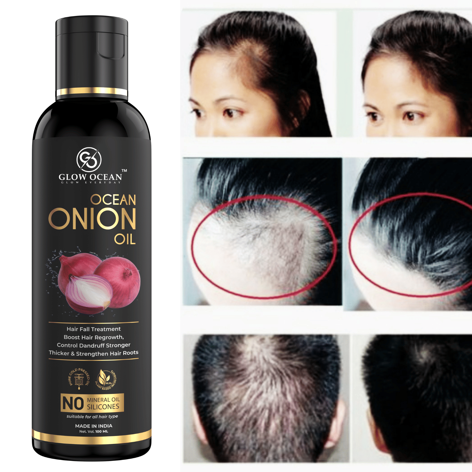     			glow ocean Anti Hair Fall Onion Oil 100 ml ( Pack of 1 )
