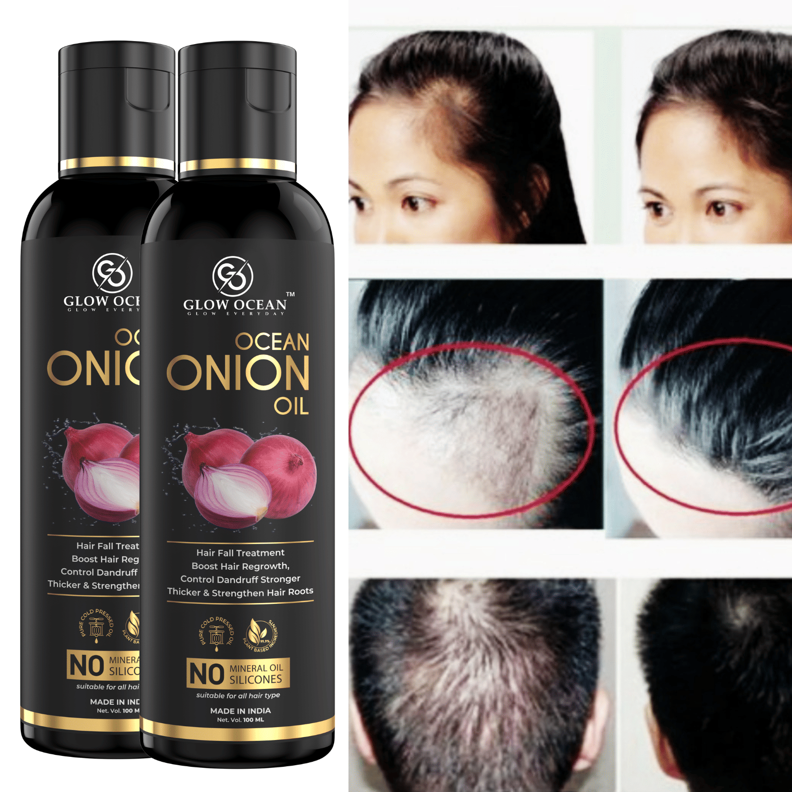 glow ocean Hair Growth Onion Oil 200 ml ( Pack of 2 ) glow ocean Hair Growth Onion Oil 200 ml ( Pack of 2 )