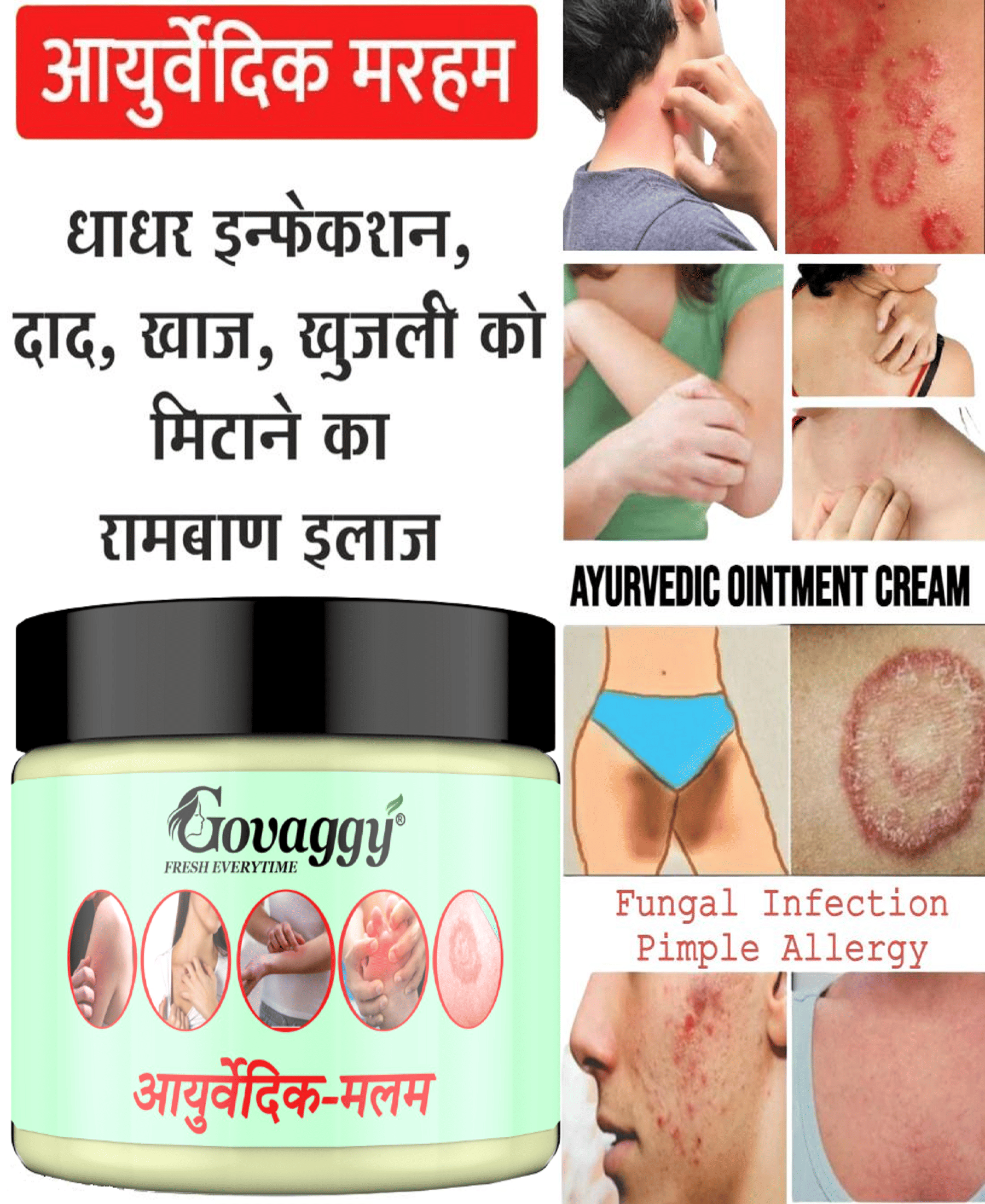 GOVAGGY Anti-Fungal & Anti-Itch Treatment Cream 25 gm GOVAGGY Anti-Fungal & Anti-Itch Treatment Cream 25 gm