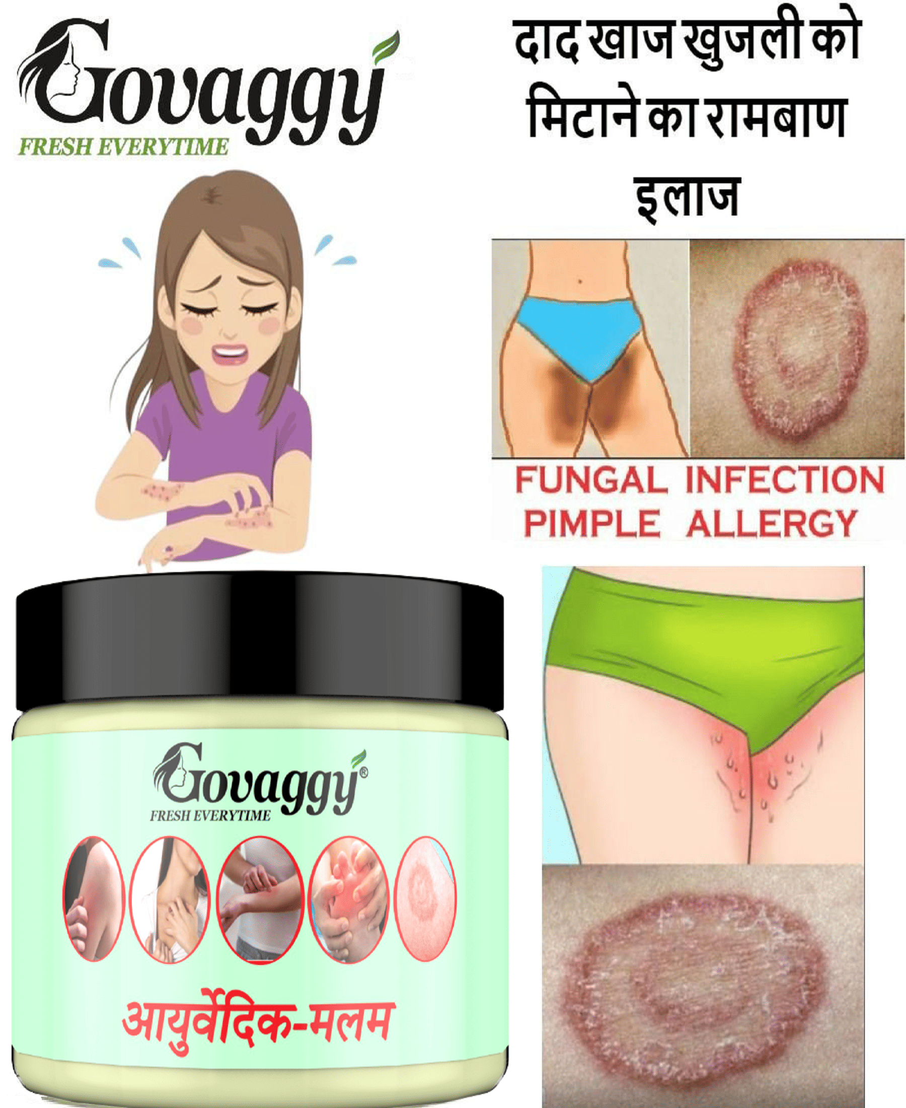 GOVAGGY Anti-Fungal & Eczema Skin Care Cream 25 gm GOVAGGY Anti-Fungal & Eczema Skin Care Cream 25 gm