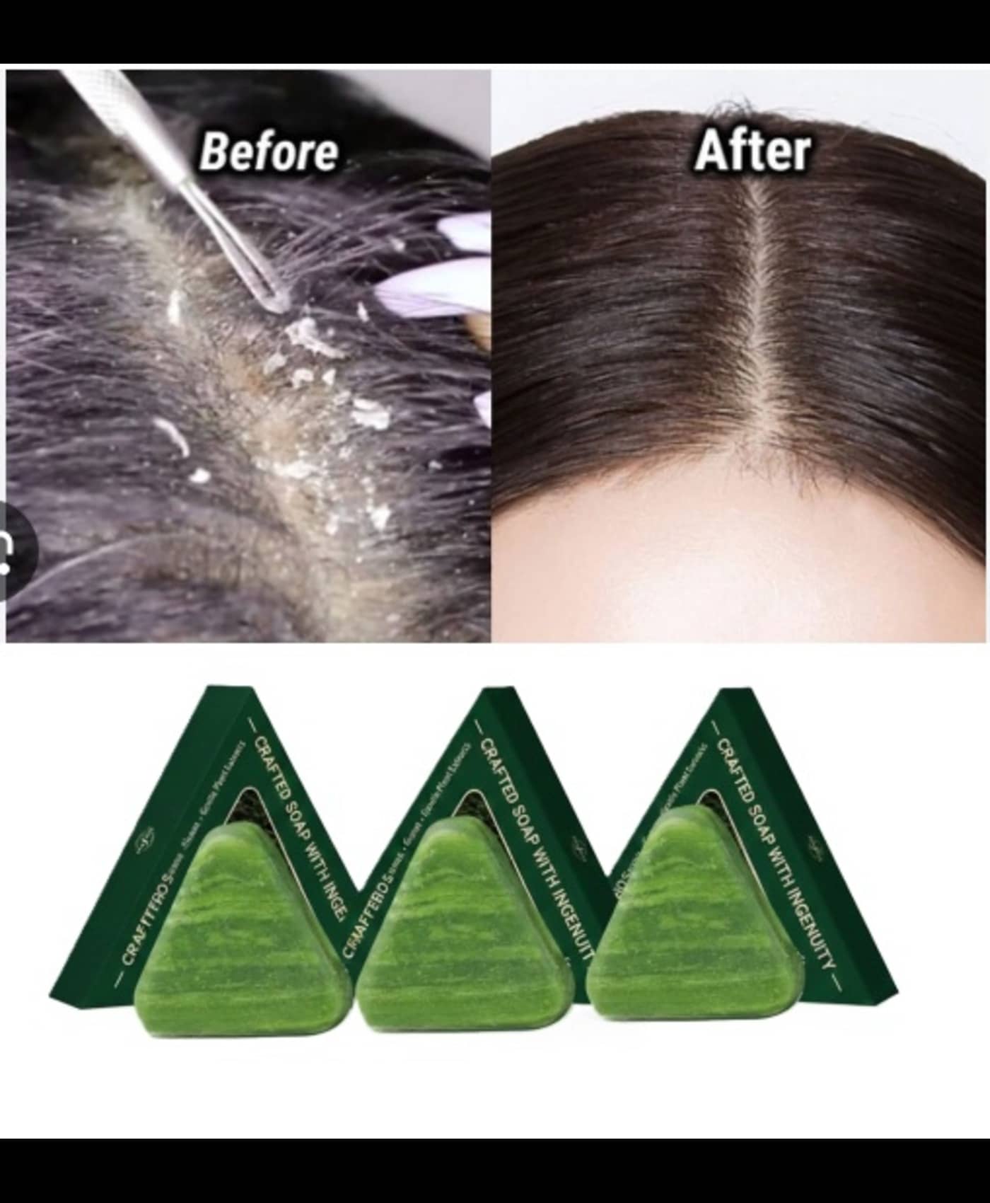 Treszo Beauty Seven Green Shampoo Bar Soap for All Skin Type ( Pack of 3 )