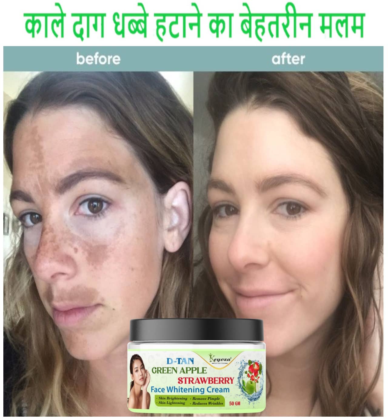 Keyoza Moisturizer All Skin Type Aloe Vera ( 50 gm )