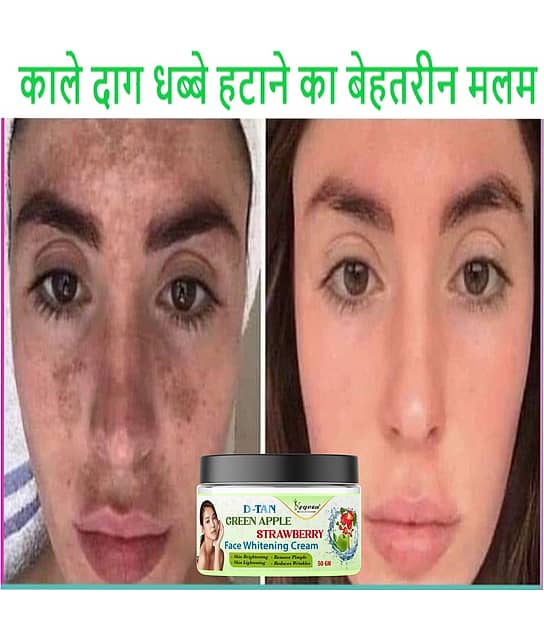 imbms Dr James Glutathione Face Whitening in 7Days Night Cream 30 gm imbms Dr James Glutathione Face Whitening in 7Days Night Cream 30 gm
