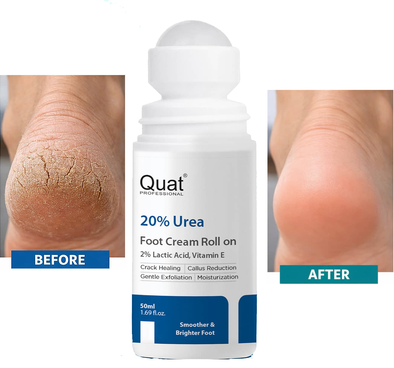 Quat Emollient Lotion for All year ( 50 g )